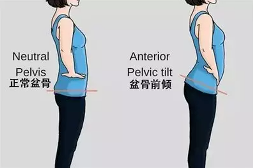 翘臀